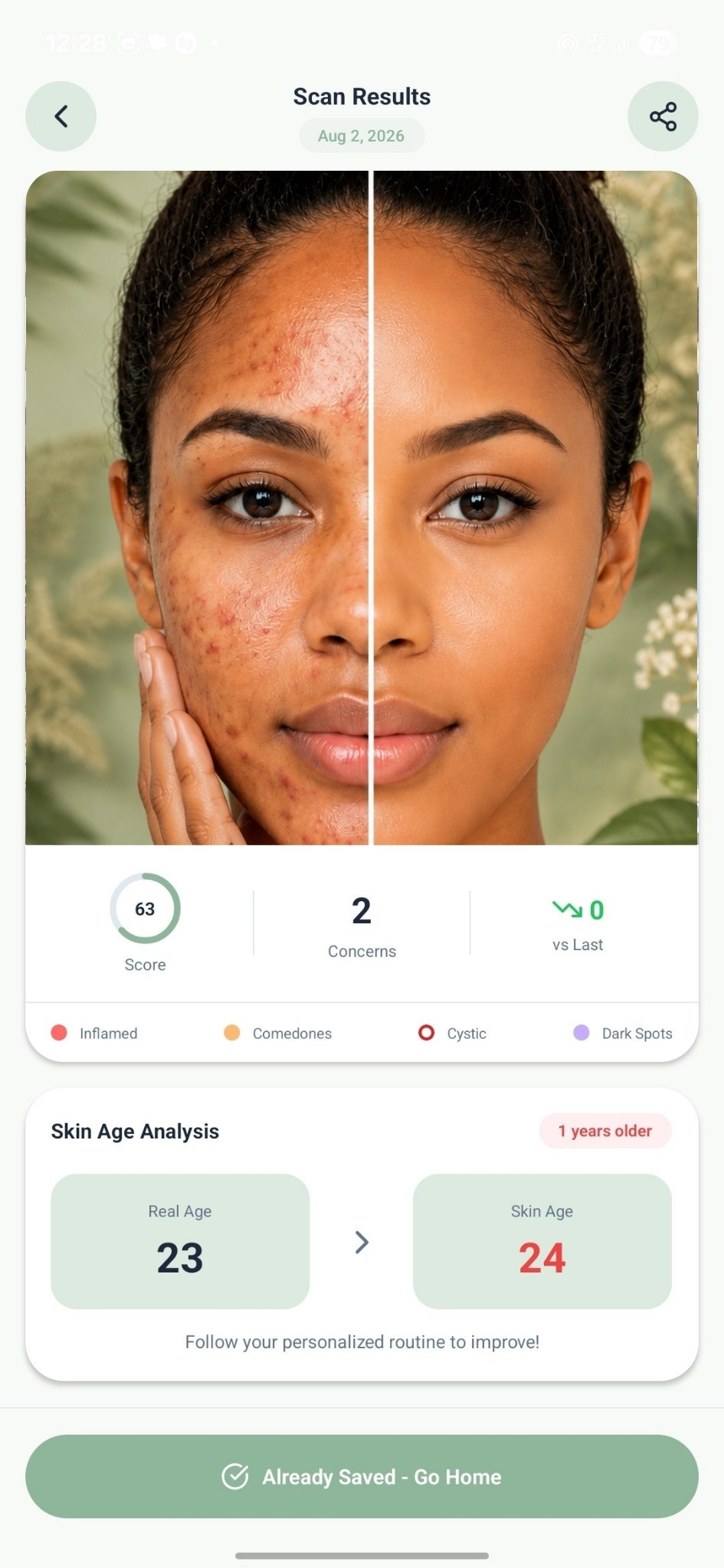 Glow Skin AI Face Scan